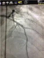 Cypress Heart & Vascular Center