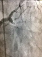Cypress Heart & Vascular Center